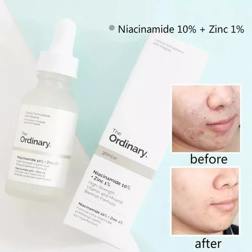 The ordinary serum niacinamide